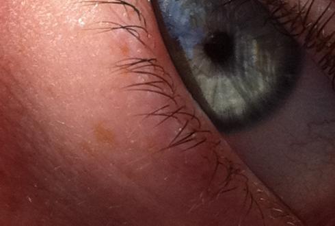 The eye's have it (phone photo)